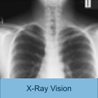 Black and white X-ray of human chest